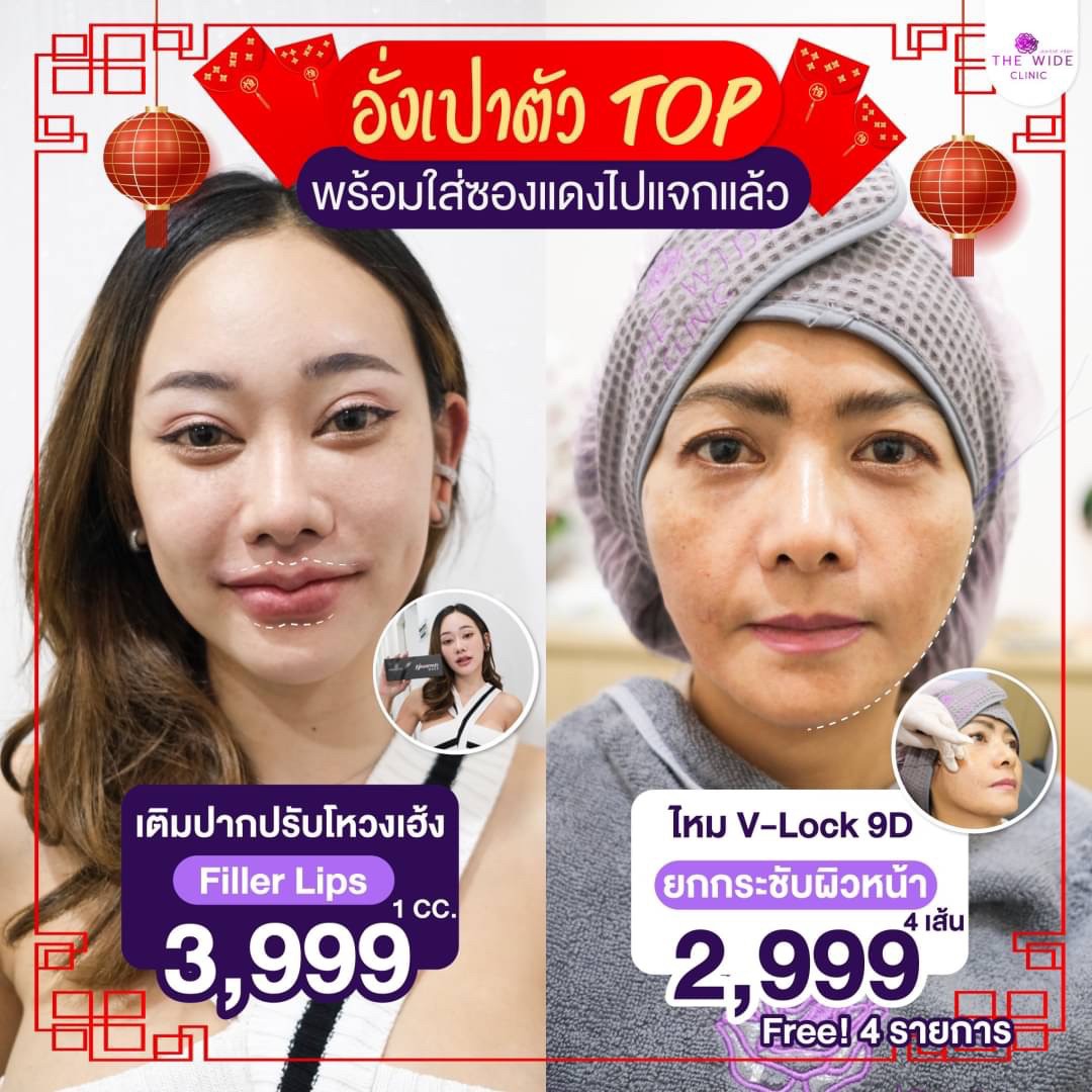 ฉีดใต้ตา